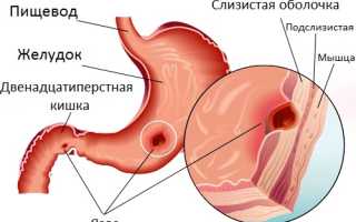 Болит весь низ живота и в спину отдает