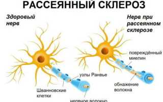Затекают плечи и болит голова