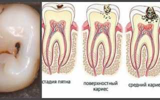 Болит вся левая часть головы глаз зубы