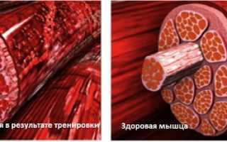 От молочной кислоты болит голова