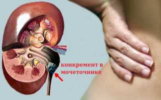 Болит спина с левой стороны что может быть