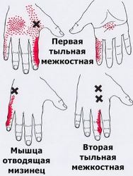 Болит точка в животе и на спине