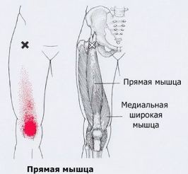 Болит точка на спине сзади