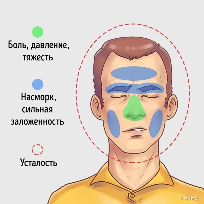 Напрягаю челюсть болит голова