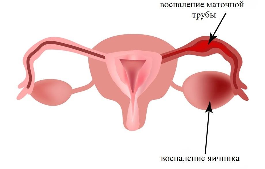 Задержка месячных и болит грудь