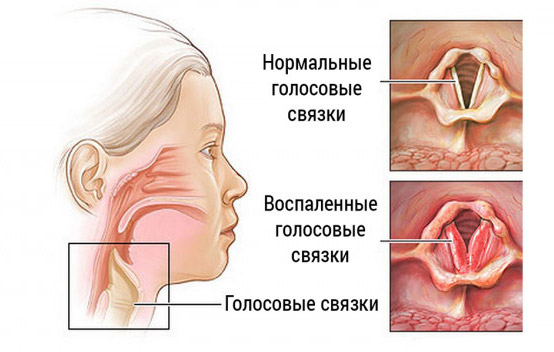 Болит спина садится голос