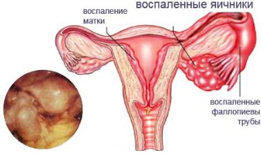 Болит спина месячные с задержкой мажут