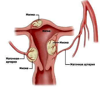 Болит спина месячные с задержкой мажут