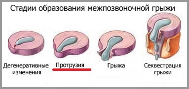 стадии