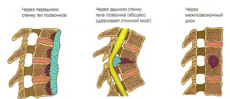 Что это может быть когда болит спина тянут руки ноги
