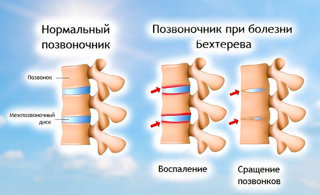 Что это может быть когда болит спина тянут руки ноги