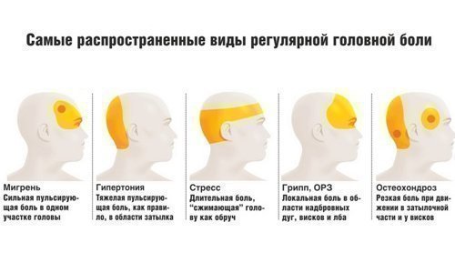 Виды боли