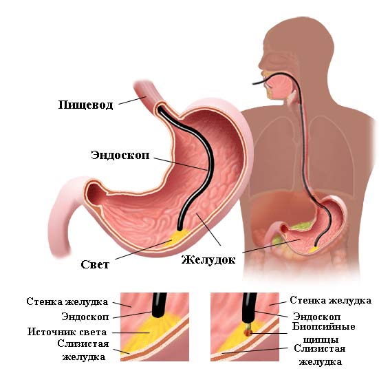 При переедании болит спина