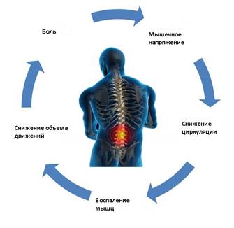 Может ли болеть спина от стресса