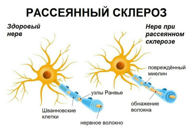 причины онемения шеи