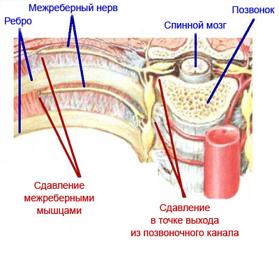 Что болит с правой стороны со спины ребер
