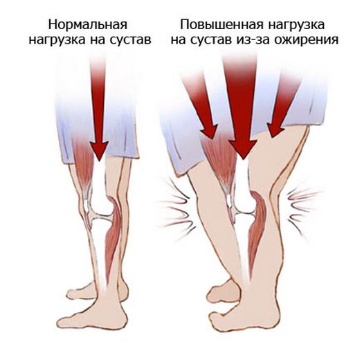 Что убрать из рациона если болит спина и суставы