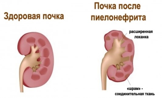 Если спина болит может быть небольшая температура