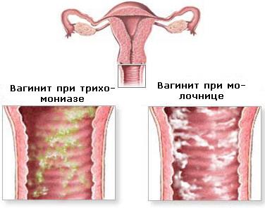 Болит спина месячные с задержкой мажут